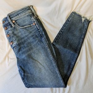 Madewell Button-Fly 10" High Rise Skinny Jeans